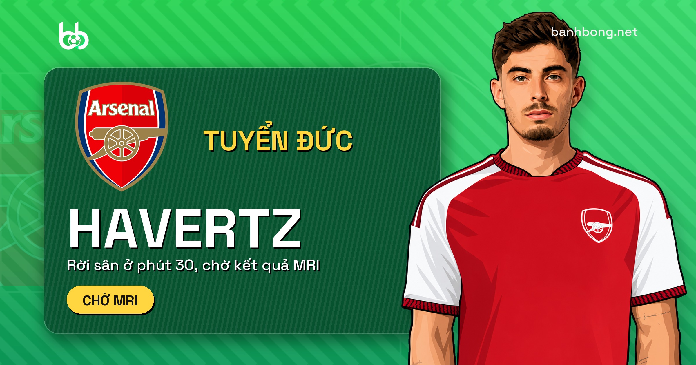 Havertz rời sân phút 30, chờ MRI cùng Musiala sau trận Đức hòa Hà Lan 1-1